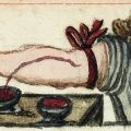 Shigehisa Kuriyama- Gleans from ‘The Expressiveness of the Body and the Divergence of Greek and Chinese Medicine’-Galen and Blood Letting