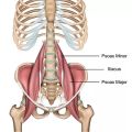 In A Nutshell: The Psoas Muscle and Trauma